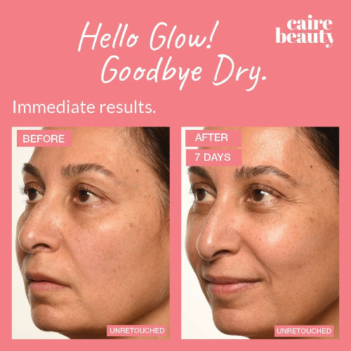 Theorem Serum Boost by Caire Beauty